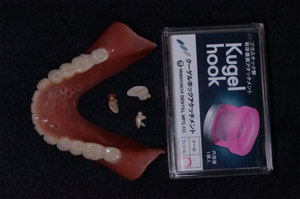 クーゲルホックAT義歯