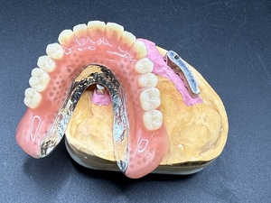 ����ץ��ȥ����С��ǥ���㡼