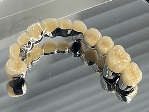 ���󥿡����Х�ȡ�MBBr